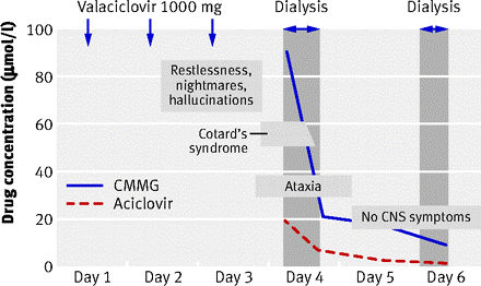 Fig. 3. Serum concentrations of acyclovir and 9-carboxymethylguanine (CMMG) in relation to neuropsychiatric symptoms of Cotard’s symptoms (Hellden 2007)
