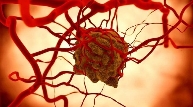 Eat to Defeat Cancer—Angiogenesis and the Promise it Carries